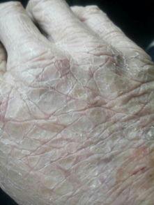 手长茧图片,手长茧的劳动者印记  第3张