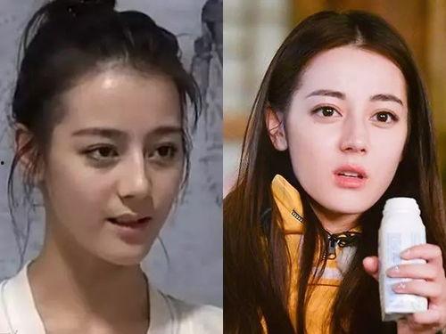 明星都是怎么变白的,揭秘明星如何轻松拥有白皙肌肤